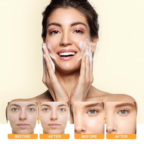 Limpiador Facial Iluminador con Extracto de Cúrcuma y Ácido Kójico